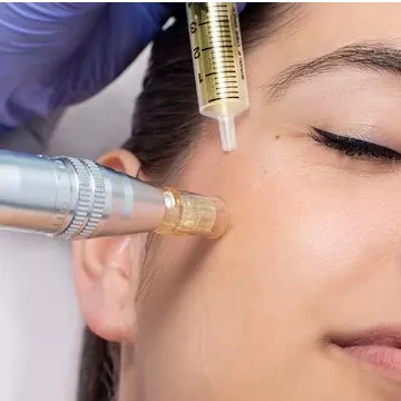 DERMAPEN Y MICRONEEDLING