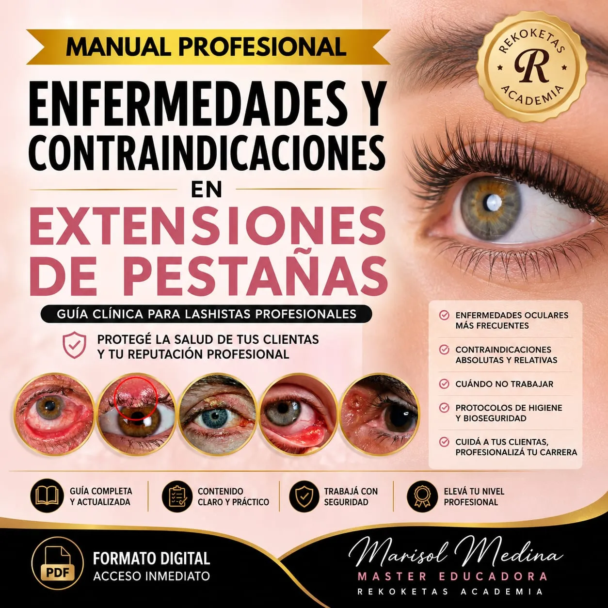 ENFERMEDADES Y CONTRAINDICACIONES EN EXTENSIONES DE PESTAÑAS