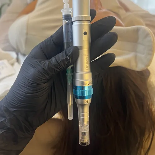 Dermaplaning + microneedling