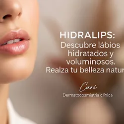 Hydra Lips ( hidratación de labios ) 