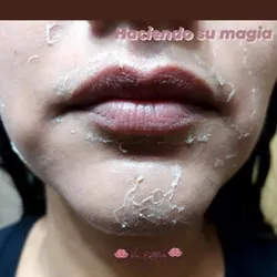 Glow Peeling 