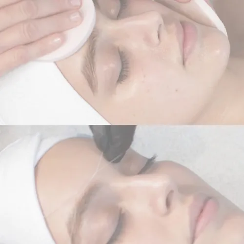 SKIN AND DEPI