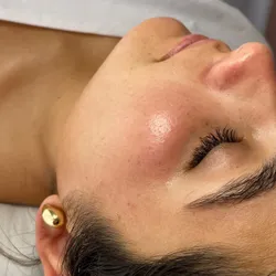 Dermaplaning 