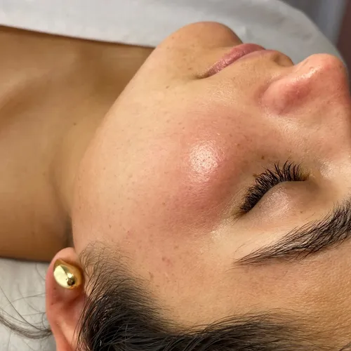 Dermaplaning 