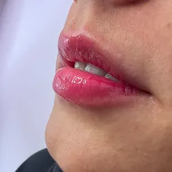 Glow lips