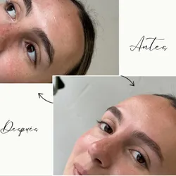10- COLORIMETRIA COMPLETA CEJAS. ILuminacion + Colorimetria Selectiva.