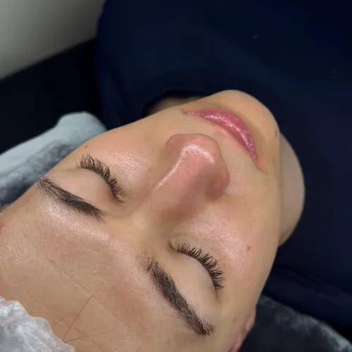 Limpieza Facial Profunda PREMIUM 