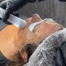 RADIOFRECUENCIA ANTI AGE con higiene facial profunda 