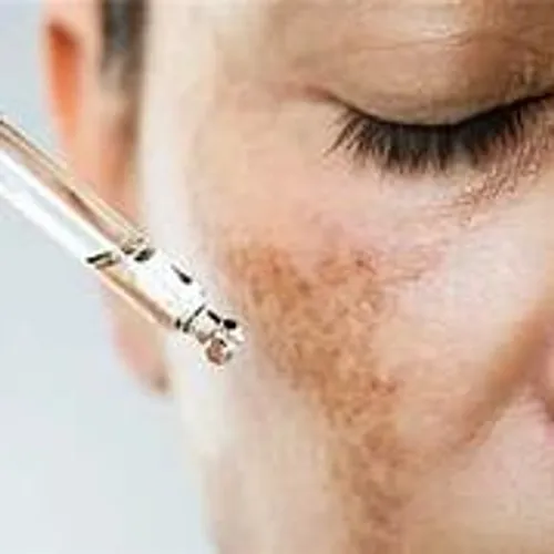 Melanostop (tratamiento para maculas y melasma)