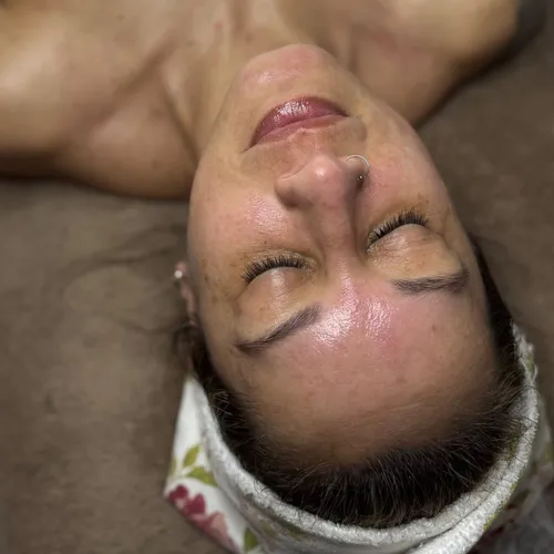FACIAL + LIFTING + PERFILADO