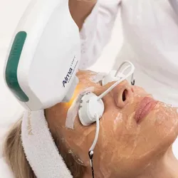 IPL LUZ PULSADA mas Peeling de regalo