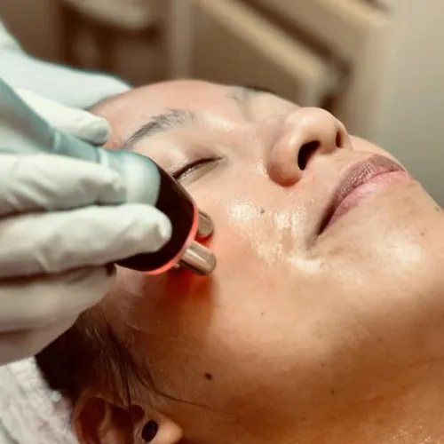 Radiofrecuencia facial mantenimiento 