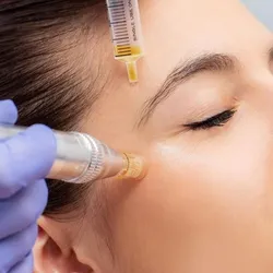 Cosmetologia con microneelding