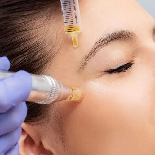 Cosmetologia con microneelding