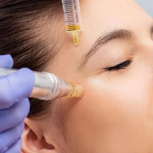 Cosmetologia con dermaplaning y microneelding