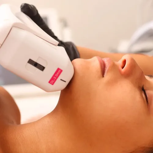 Hifu Rostro y papada 