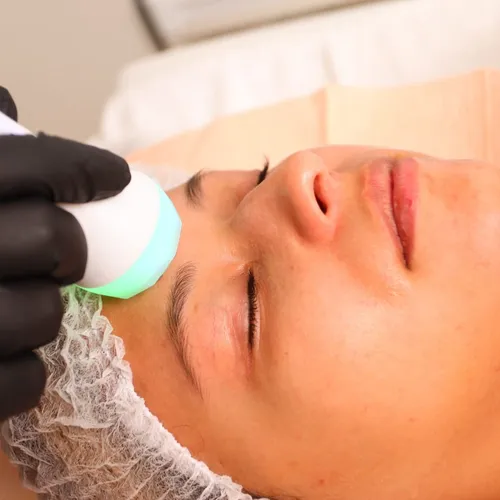 Radio Frecuencia Facial