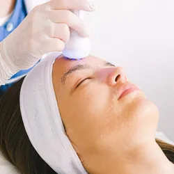 Electroporación facial 