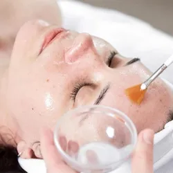 Peeling químico 