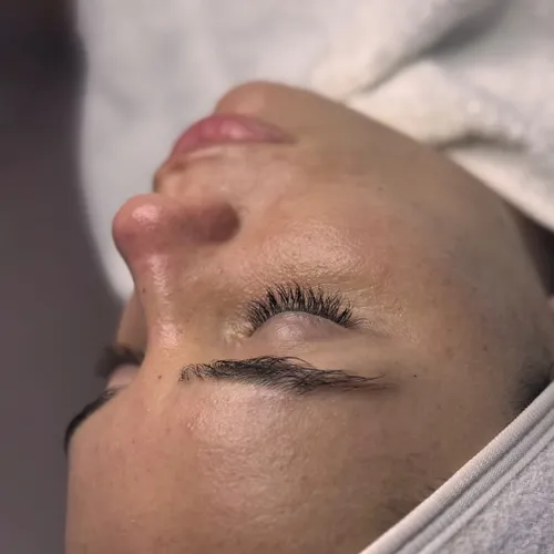 Limpieza facial profunda y peeling encimatico 