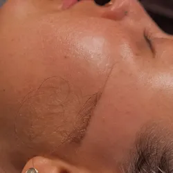 Limpieza facial profunda + Skin GLOW Dermaplaning 