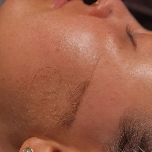 Limpieza facial profunda + Skin GLOW Dermaplaning 