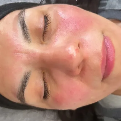 Tratamiento anti age 
