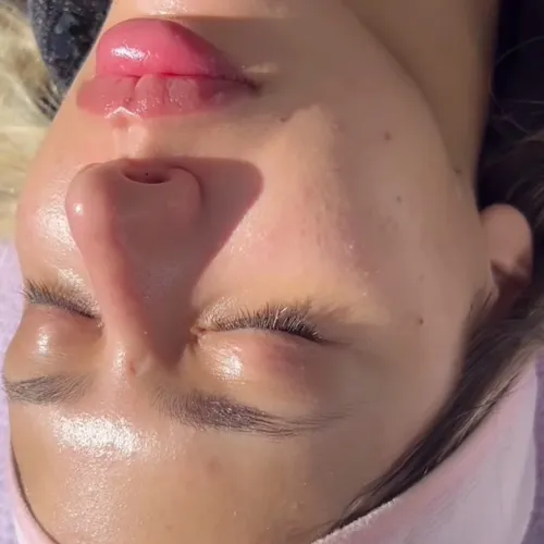Full facial premium 
