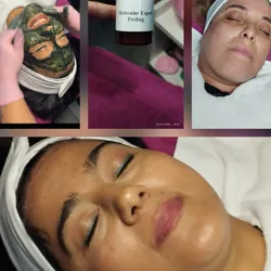 PEELING Algas - Rosasea - Lifting-Acne -Glow