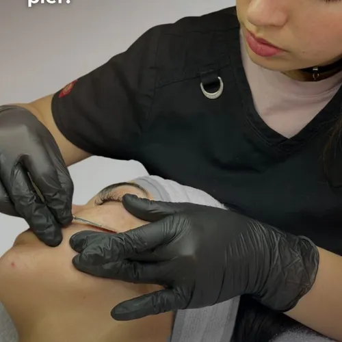 Dermaplaning -  skin glow