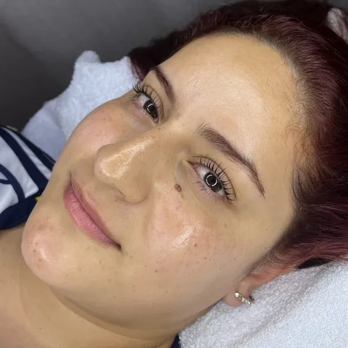 Peeling - essence peel