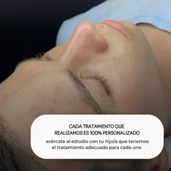 Facial para adolescentes - hydra teens 