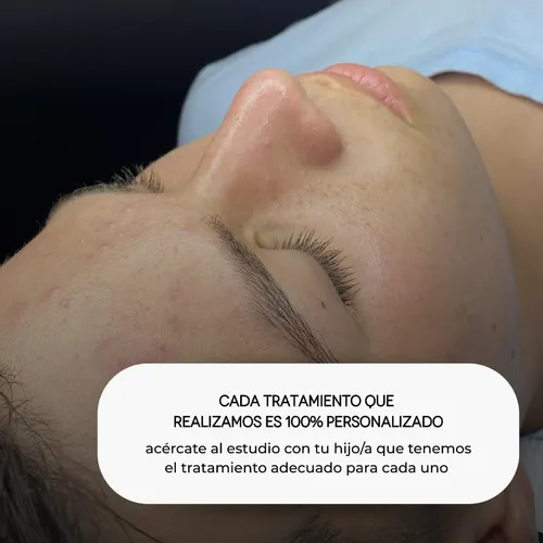 Facial para adolescentes - hydra teens 