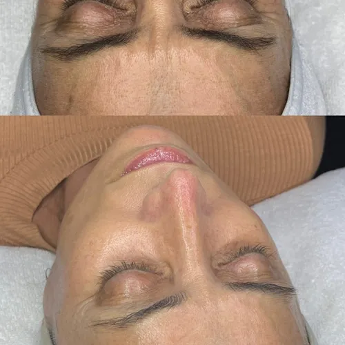 Tratamiento anti age - eternal radiance