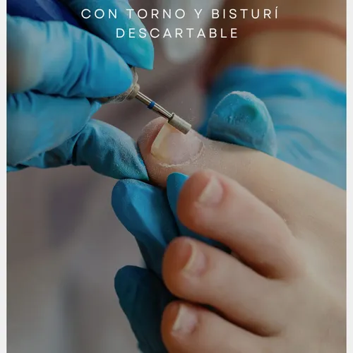 Pedicuria 