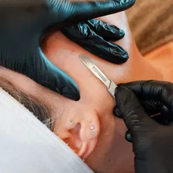 LIMPIEZA FACIAL PROFUNDA + DERMAPLANING