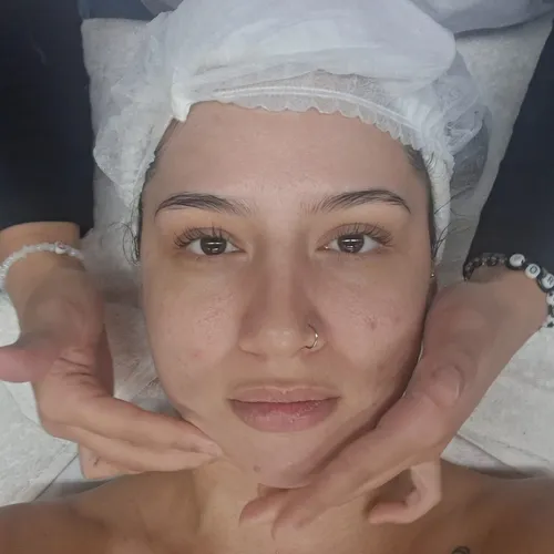 LIMPIEZA FACIAL promo