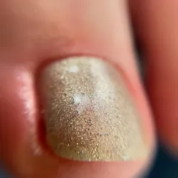 Pedicuria