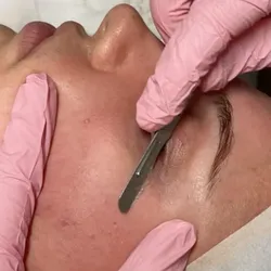 DERMAPLANING + LIMPIEZA FACIAL + Mascarilla Hidroplastica