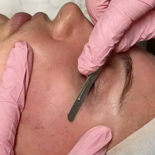 DERMAPLANING + LIMPIEZA FACIAL + Mascarilla Hidroplastica