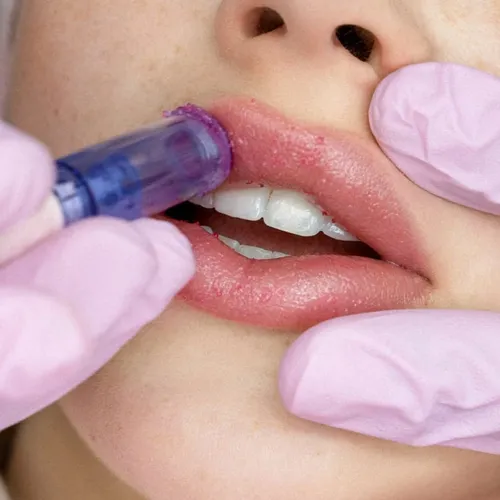 HYDRA LIPS + LIMPIEZA FACIAL 