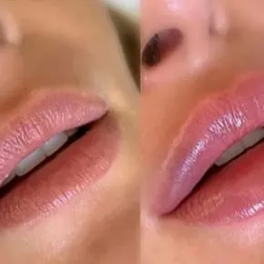HIDRA GLOW PARA TUS LABIOS