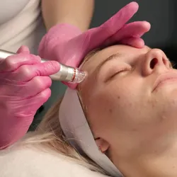 COMBO MUNDIAL GLOW Limpieza facial + Dermaplaning + Hydralip