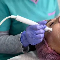 Rejuvenecimiento facial