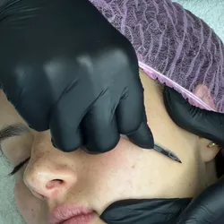 Dermaplaning