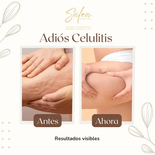 Pack x 10 anticelulitico