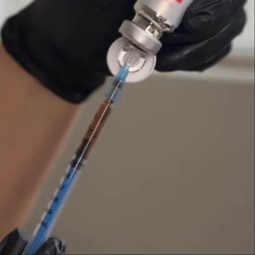 Microneedling con EXOSOMAS COREANOS