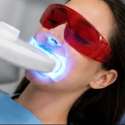 Blanqueamiento dental 