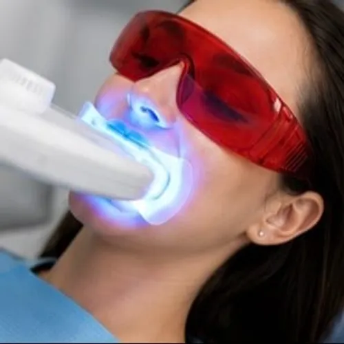 Blanqueamiento dental 