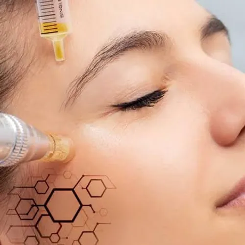     ExoGlow → Microneedling + Exosomas